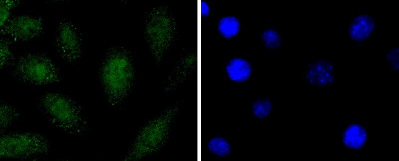 Anti-SOX1 Rabbit mAb