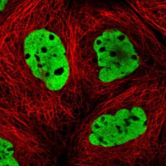 ICC: DNMT3a Antibody