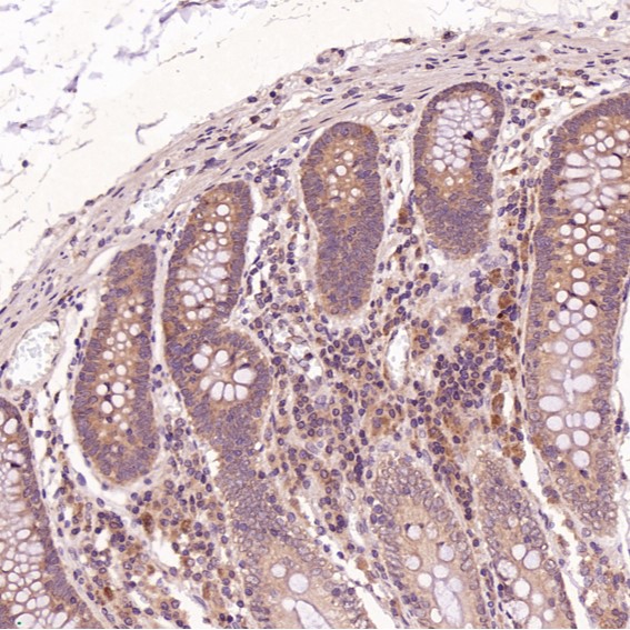 Anti-Cleaved PARP1 (Asp214) Rabbit mAb