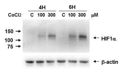 HIF1 alpha