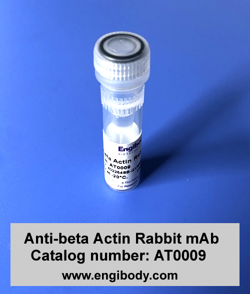 Anti-beta Actin Rabbit mAb - Loading Control