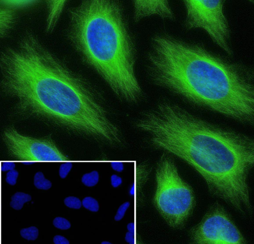 Anti-beta Tubulin Rabbit mAb