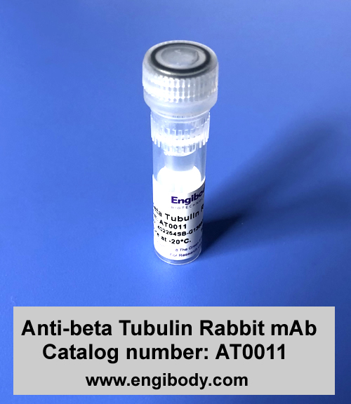 Anti-beta Tubulin Rabbit mAb - Loading Control