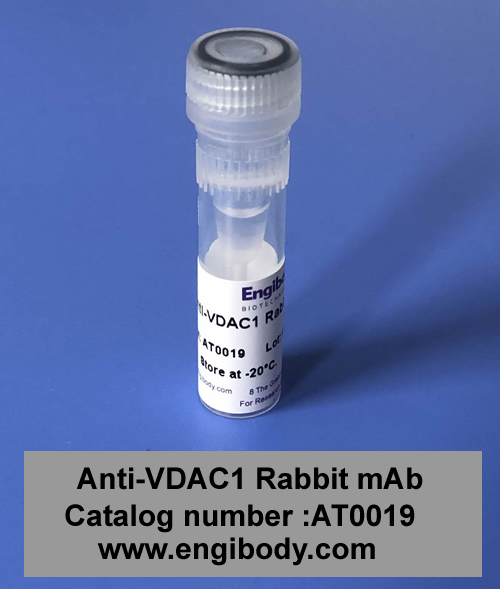 Anti-VDAC1/Porin Rabbit mAb - Mitochondrial Loading Control