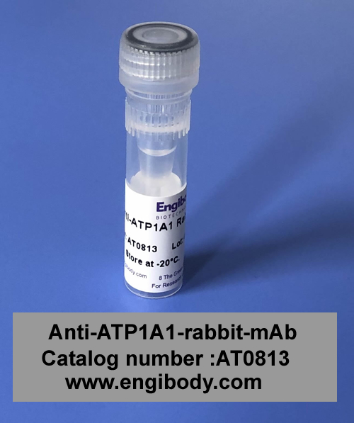 Anti-Sodium Potassium ATPase (ATP1A1) rabbit mAb - Cell Membrane Loading Control