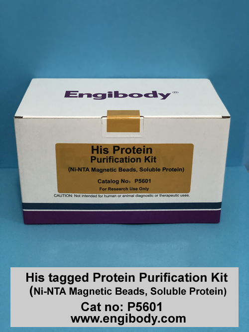 His tagged Fusion Protein Purification Kit (Ni-NTA Magnetic Beads, Soluble Protein)