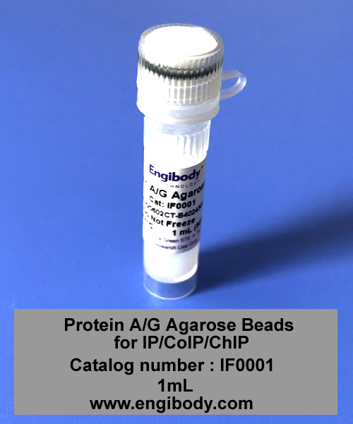 Protein A/G Agarose Beads for IP/CoIP/ChIP