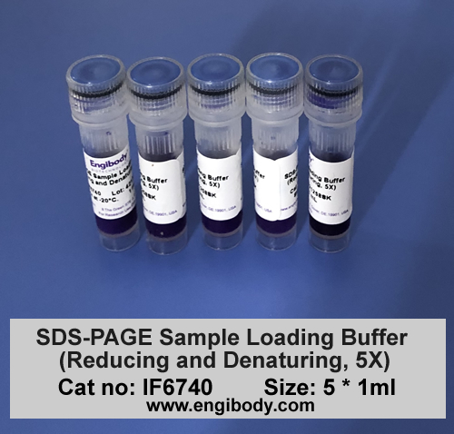 SDS-PAGE Sample Loading Buffer (Reducing and Denaturing, 5X)