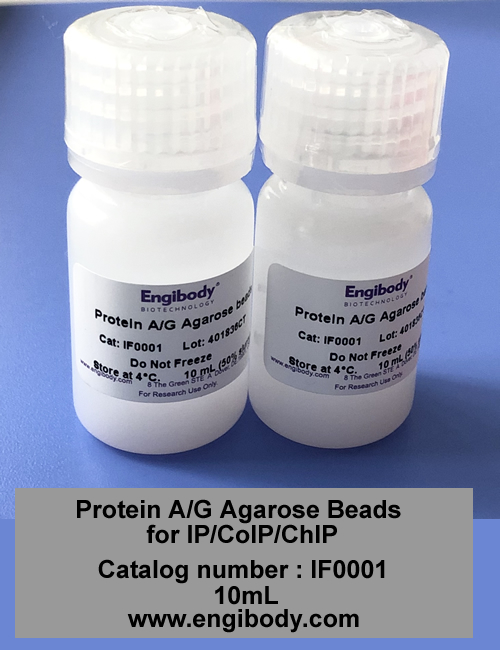 Protein A/G Agarose Beads for IP/CoIP/ChIP
